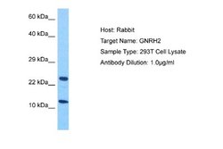 GNRH2 Rabbit anti-Human, Polyclonal, Novus Biologicals 0.1ml; Unconjugated:Antibodies,